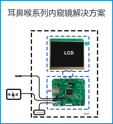 耳喉鼻系列內(nèi)窺鏡解決方案