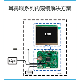 耳喉鼻系列內(nèi)窺鏡解決方案